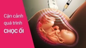 Thời điểm thực hiện xét nghiệm ADN cha con khi mang thai