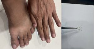 Quy trình các bước thu thập mẫu móng tay móng chân xét nghiệm ADN tại Viện LOCI
