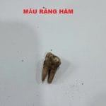 Xương / răng